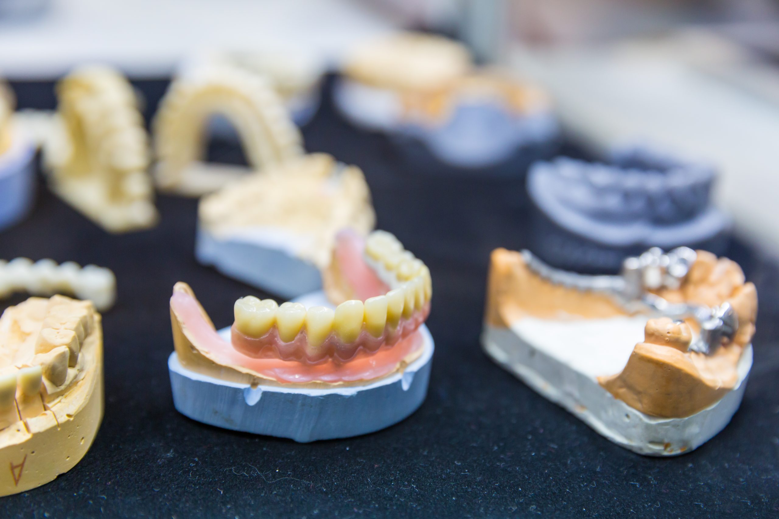 Kuo naudingi dantų implantai?